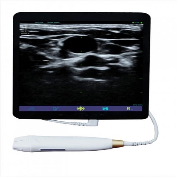 Handheld ultrasound device CBLMU06